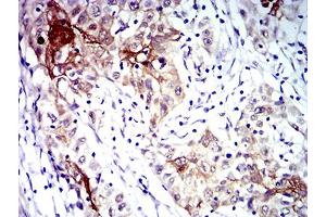 Immunohistochemistry (IHC) image for anti-Chemokine (C-X-C Motif) Receptor 3 (CXCR3) antibody (ABIN5611329)