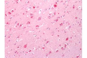 Human Brain, Cortex: Formalin-Fixed, Paraffin-Embedded (FFPE) (CNR1 Antikörper  (Cytoplasmic Domain))
