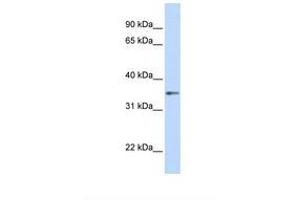 Image no. 1 for anti-Guanine Nucleotide Binding Protein (G Protein), beta Polypeptide 1 (GNB1) (AA 254-303) antibody (ABIN6738973)