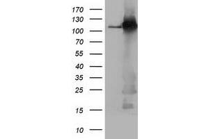 Western Blotting (WB) image for anti-Budding Uninhibited By Benzimidazoles 1 Homolog beta (Yeast) (BUB1B) antibody (ABIN1496997) (BUB1B Antikörper)