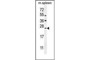 Western blot analysis of LMO4 Antibody (Center) in mouse spleen tissue lysates (35ug/lane). (LMO4 Antikörper  (Middle Region))