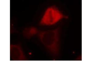 Image no. 1 for anti-Mitogen-Activated Protein Kinase Kinase 3 (MAP2K3) (pSer189) antibody (ABIN196862) (MAP2K3 Antikörper  (pSer189))