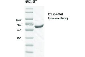 WHSC1L1 Protein (AA 1021-1320) (GST tag)