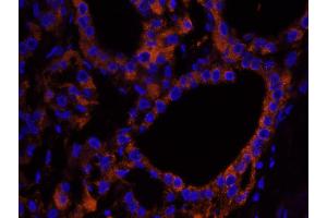 Immunofluorescence (IF) image for anti-Neurofibromin 2 (NF2) (C-Term) antibody (ABIN7448991) (Merlin Antikörper  (C-Term))