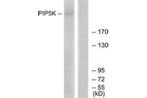 Western blot analysis of extracts from HepG2 cells, using PIP5K Antibody.