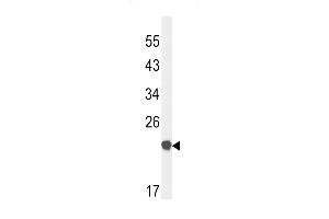 Claudin 23 Antikörper  (C-Term)