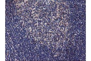 Image no. 3 for anti-Diacylglycerol Kinase, alpha 80kDa (DGKA) antibody (ABIN1497815) (DGKA Antikörper)