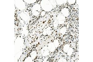 IHC analysis of KAP1/TRIM28 using anti-KAP1/TRIM28 antibody (ABIN7602310).