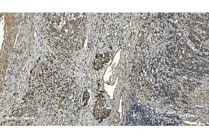 IHC analysis of RGS6 using anti-RGS6 antibody (ABIN7602326). (RGS6 Antikörper  (AA 7-357))