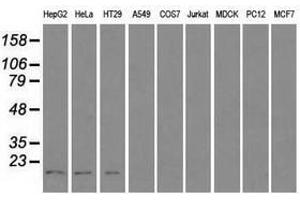 Image no. 2 for anti-Cancer/testis Antigen 1B (CTAG1B) antibody (ABIN1499904) (CTAG1B Antikörper)