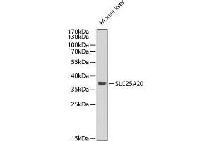 Western blot analysis of extracts of various cell lines, using SLC25 antibody (ABIN6129250, ABIN6147917, ABIN6147919 and ABIN6218142) at 1:440 dilution. (SLC25A20 Antikörper  (AA 1-301))