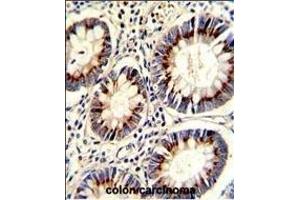Immunohistochemistry (Paraffin-embedded Sections) (IHC (p)) image for anti-Thymidylate Synthetase (TYMS) (AA 265-294), (C-Term) antibody (ABIN1882144)