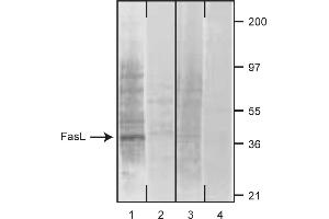 Western Blotting (WB) image for anti-Fas Ligand (TNF Superfamily, Member 6) (FASL) antibody (ABIN1176953)