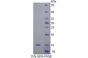 SDS-PAGE (SDS) image for Signal Recognition Particle 9kDa (SRP9) (AA 2-86) protein (His tag) (ABIN4988779)