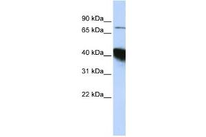 Western Blotting (WB) image for anti-CBP80/20-Dependent Translation Initiation Factor (CTIF) antibody (ABIN2458532) (CTIF/KIAA0427 Antikörper)