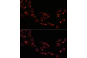 Immunofluorescence analysis of U-2 OS cells using NSDHL antibody (ABIN7268794) at dilution of 1:100.