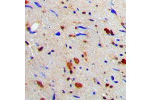 Immunohistochemical analysis of MGCRACGAP staining in human brain formalin fixed paraffin embedded tissue section. (RACGAP1 Antikörper  (N-Term))