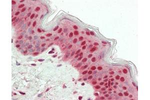 Human Skin: Formalin-Fixed, Paraffin-Embedded (FFPE) (USP7 Antikörper  (AA 1-50))