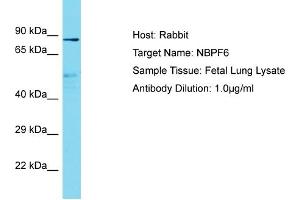 Host: Rabbit Target Name: NBPF6 Sample Type: Fetal Lung lysates Antibody Dilution: 1. (NBPF6 Antikörper  (C-Term))
