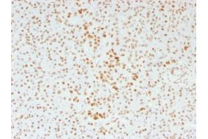 Formalin-fixed, paraffin-embedded human Pancreas stained with ATRX Mouse Monoclonal Antibody (39f). (ATRX Antikörper)
