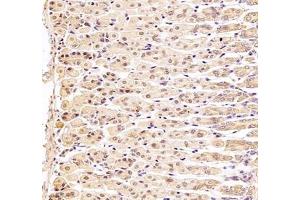 Immunohistochemistry (Paraffin-embedded Sections) (IHC (p)) image for anti-DEAD (Asp-Glu-Ala-As) Box Polypeptide 19B (DDX19B) antibody (ABIN7073694)