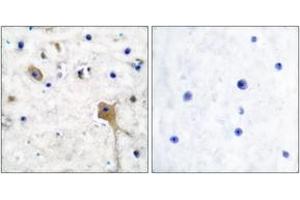 Immunohistochemistry analysis of paraffin-embedded human brain tissue, using SH-PTP2 Antibody. (PTPN11 Antikörper  (AA 321-370))
