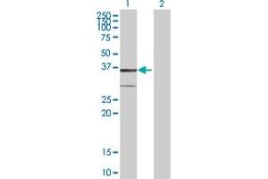 Western Blotting (WB) image for anti-3-hydroxybutyrate Dehydrogenase, Type 1 (BDH1) (AA 1-343) antibody (ABIN513696)