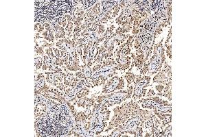 IHC analysis of SAE1 using anti-SAE1 antibody (ABIN7601346). (SAE1 Antikörper  (AA 33-299))