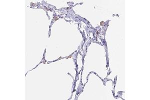 Immunohistochemical staining (Formalin-fixed paraffin-embedded sections) of human lung with FCGR3A polyclonal antibody  shows positivity in macrophages. (FCGR3A Antikörper  (AA 227-254))