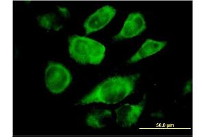 Immunofluorescence of monoclonal antibody to SSR4 on HeLa cell. (SSR4 Antikörper  (AA 24-173))