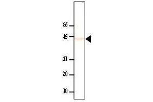 Western Blotting (WB) image for anti-Protein Phosphatase, Mg2+/Mn2+ Dependent, 1A (PPM1A) (AA 1-382) antibody (ABIN933064)