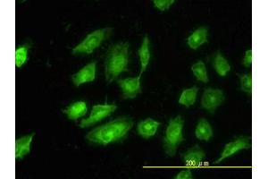 Image no. 2 for anti-Tropomyosin 4 (TPM4) (AA 1-249) antibody (ABIN598984) (Tropomyosin 4 Antikörper  (AA 1-249))