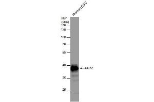 WB Image SOX2 antibody detects SOX2 protein by western blot analysis. (SOX2 Antikörper)
