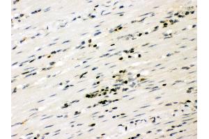 Immunohistochemistry (IHC) image for anti-Runt-Related Transcription Factor 3 (RUNX3) (AA 128-270) antibody (ABIN3043429)