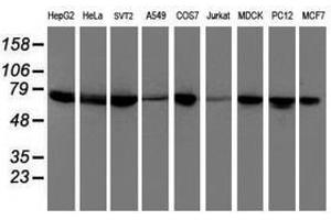 Image no. 2 for anti-Dystrobrevin, beta (DTNB) antibody (ABIN1497915) (Dystrobrevin beta Antikörper)