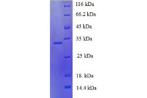 SDS-PAGE (SDS) image for Neuroglobin (NGB) (AA 1-151), (full length) protein (His-SUMO Tag) (ABIN5710007)
