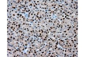 Immunohistochemical staining of paraffin-embedded Kidney tissue using anti-ERCC1 mouse monoclonal antibody. (ERCC1 Antikörper)