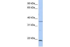 WB Suggested Anti-SPRY2 Antibody Titration: 0. (SPRY2 Antikörper  (Middle Region))