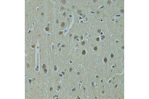 Immunohistochemistry of paraffin-embedded rat brain using UBE2I antibody. (UBE2I Antikörper  (AA 1-158))