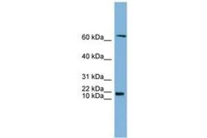 Image no. 1 for anti-GM2 Ganglioside Activator (GM2A) (N-Term) antibody (ABIN6743402) (GM2A Antikörper  (N-Term))