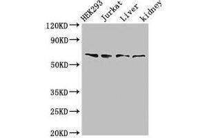Western Blot Positive WB detected in: HEK293 whole cell lysate, Jurkat whole cell lysate, Rat liver tissue, Rat kidney tissue All lanes: TXK antibody at 3 μg/mL Secondary Goat polyclonal to rabbit IgG at 1/50000 dilution Predicted band size: 62 kDa Observed band size: 62 kDa (TXK Antikörper  (AA 32-83))