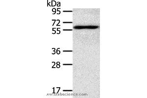Western blot analysis of TM4 cell, using RORA Polyclonal Antibody at dilution of 1:400 (RORA Antikörper)