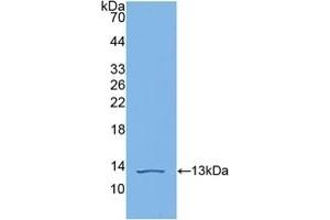 Detection of Recombinant C4b, Human using Polyclonal Antibody to Complement C4-B (C4B) (C4B Antikörper  (AA 680-756))
