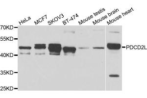 Western blot analysis of extracts of various cell lines, using PDCD2L antibody. (PDCD2L Antikörper)