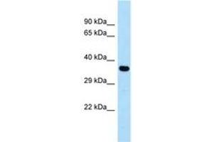 Image no. 1 for anti-Cysteinyl Leukotriene Receptor 1 (CYSLTR1) (AA 199-248) antibody (ABIN6747993) (CysLTR1 Antikörper  (AA 199-248))