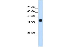 WB Suggested Anti-SQLE Antibody Titration: 0. (SQLE Antikörper  (C-Term))