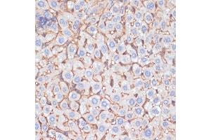 Immunohistochemistry of paraffin-embedded mouse liver using  antibody (ABIN6129926, ABIN6136997, ABIN6136998 and ABIN6218500) at dilution of 1:100 (40x lens). (APOA1 Antikörper  (AA 25-267))