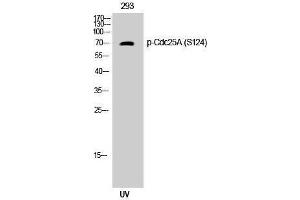 Western Blotting (WB) image for anti-Cell Division Cycle 25 Homolog A (S. Pombe) (CDC25A) (pSer124) antibody (ABIN3182248) (CDC25A Antikörper  (pSer124))