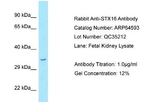 Western Blotting (WB) image for anti-Syntaxin 16 (STX16) (C-Term) antibody (ABIN2789888) (Syntaxin 16 Antikörper  (C-Term))