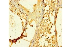 Immunohistochemistry of paraffin-embedded human testis tissue using ABIN7170528 at dilution of 1:100 (SPATS1 Antikörper  (AA 1-300))
